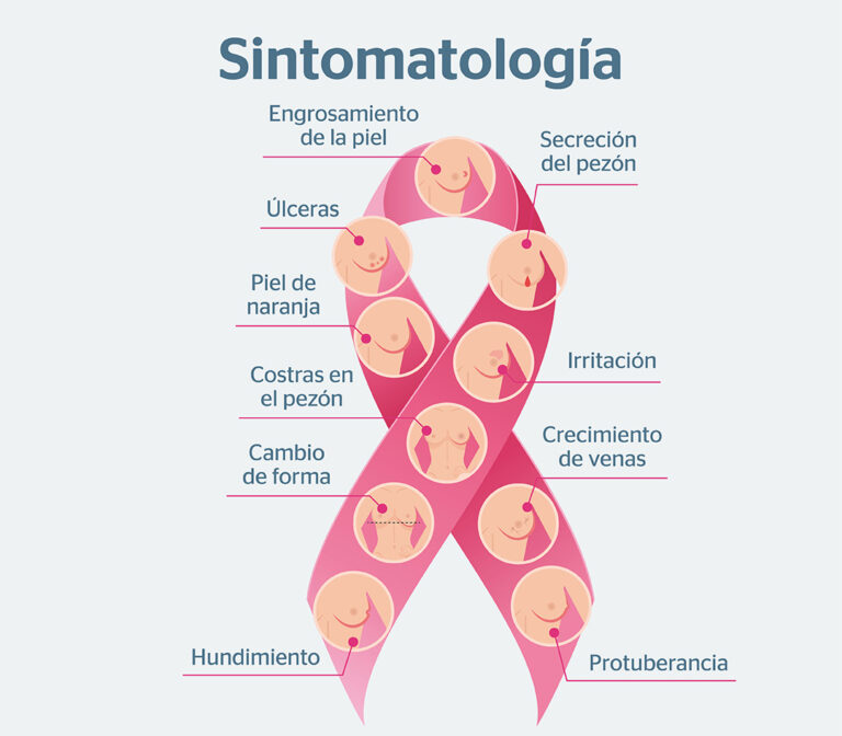 Síntomas de alerta. FOTO: Institute of Oncology 